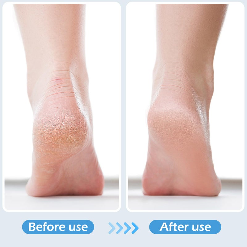 TaShow 3 Pcs 4 in 1 Foot Brush for Use in Shower with Pumice Stone  Foot Rasp and Sandpaper  Foot Scrubber Brush for Feet  Dead Skin Remover for Foot Care - Image 5